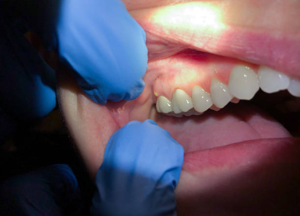 Trusted ME Emergency Dental Service Experts